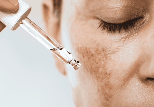 Understanding Hyper-pigmentation: More Than Just a Skin Concern