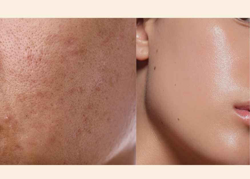 AHA Peeling Concentrate