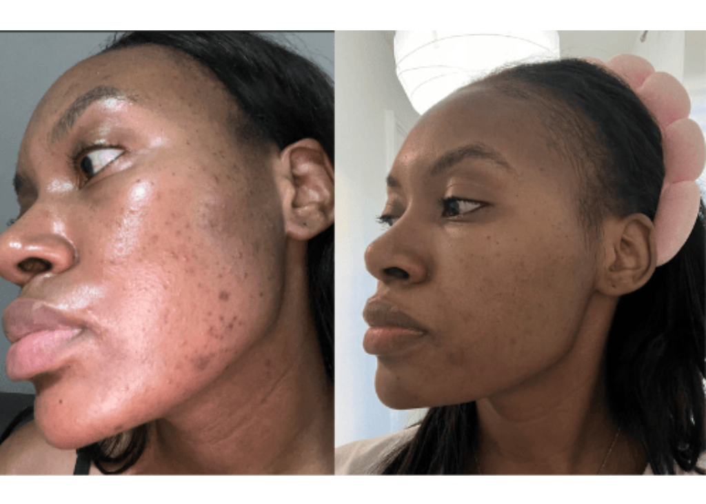 Pigment Perfecting Serum