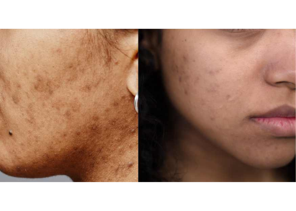 Pigment Perfecting Serum
