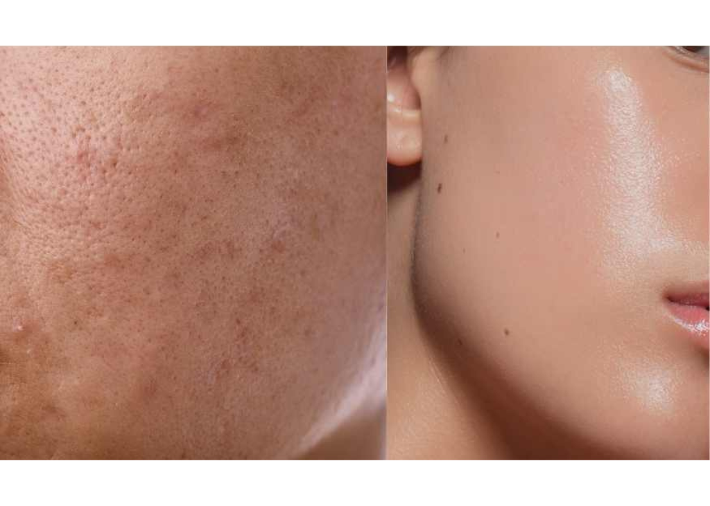 Pigment Perfecting Serum