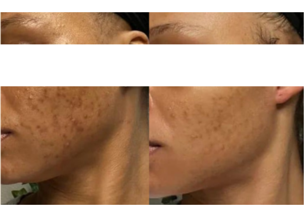 Pigment Perfecting Serum