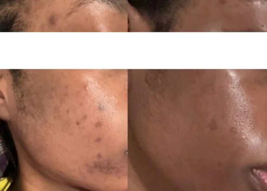 Pigment Perfecting Serum