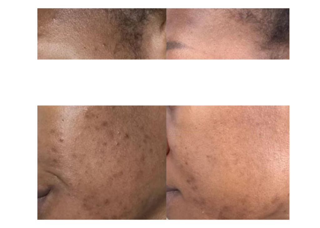 Pigment Perfecting Serum